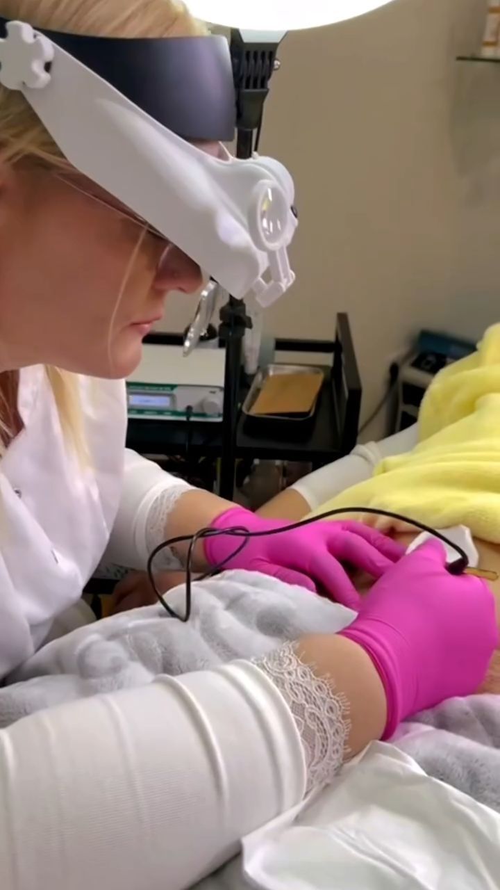 Elektroepilation im Studio: die Kosmetikerin arbeitet mit Lupenbrille und feiner Sonde