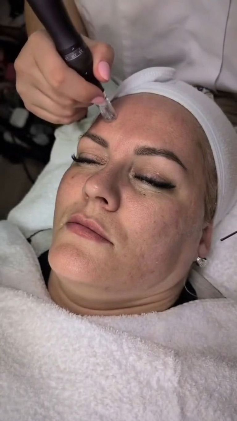 Apparative Derma-Series-Gesichtsbehandlung im Ariona-Beauty-Studio